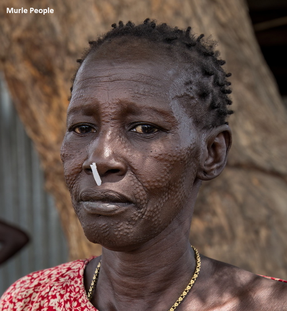 Murle Scarifications